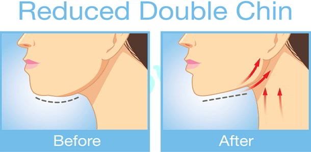 reduce-double-chin