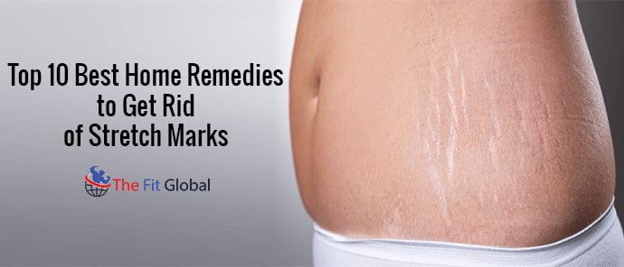 top-10-best-home-remedies-to-get-rid-of-stretch-marks