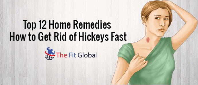 top-12-home-remedies-how-to-get-rid-of-hickeys-fast