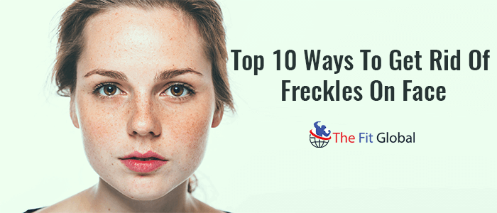Top 10 Ways To Get Rid Of Freckles On Face