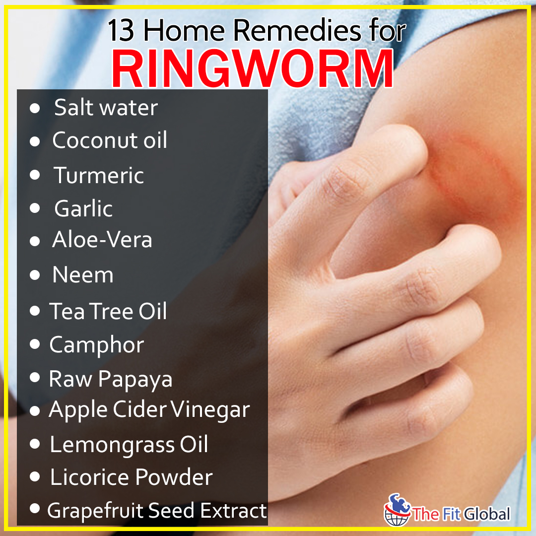 home remedies for ringworm cure