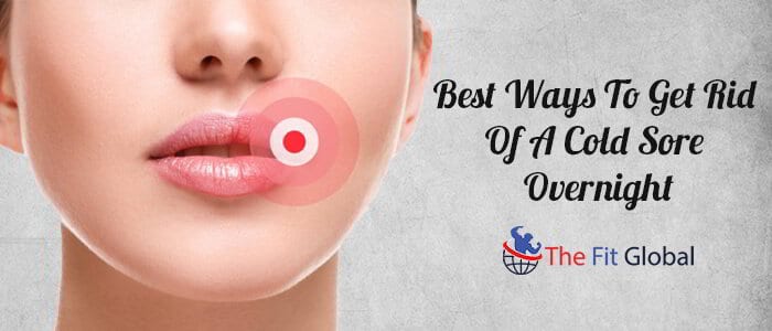 Best Ways To Get Rid Of A Cold Sore Overnight