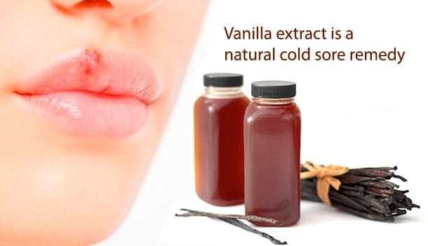 Vanilla extract for cold sore