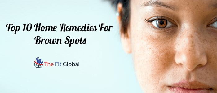 Top 10 Home Remedies For Brown Spots