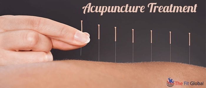 Best and Broad Alternate Therapy For Your Ailments – Acupuncture Treatment