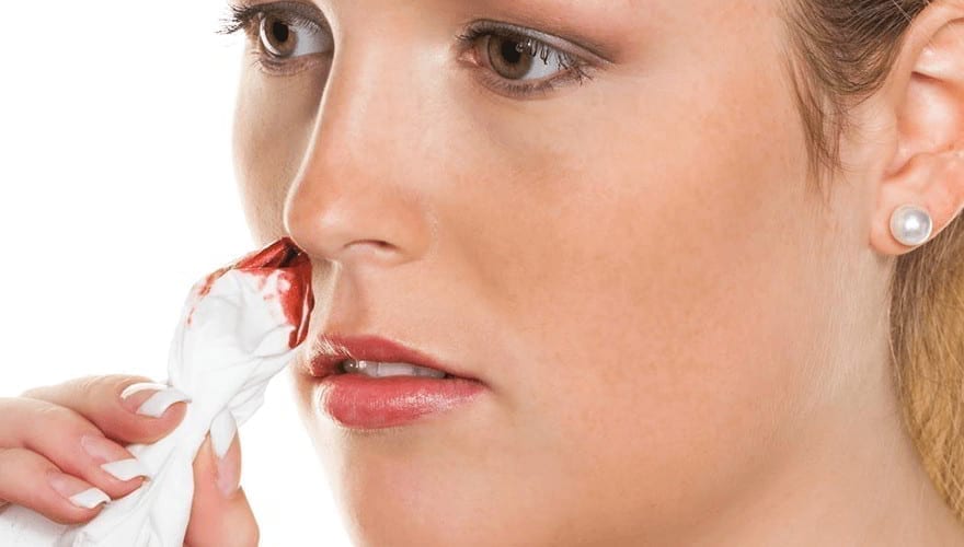 Stop Nose Bleeding Quickly