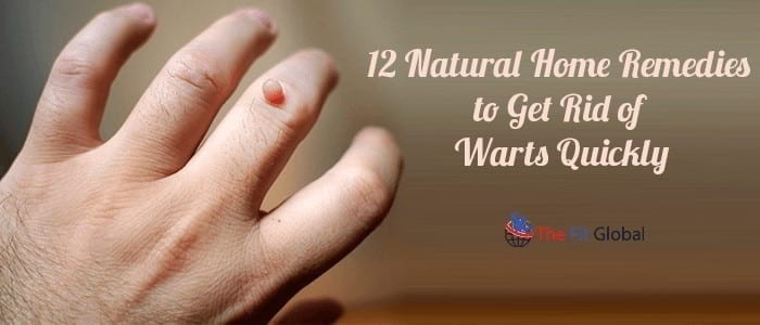 12 Natural Home Remedies to Get Rid of Warts Quickly