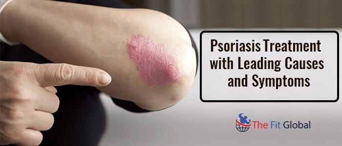 Treat Psoriasis at Home Psoriasis Treatment along with Symptoms