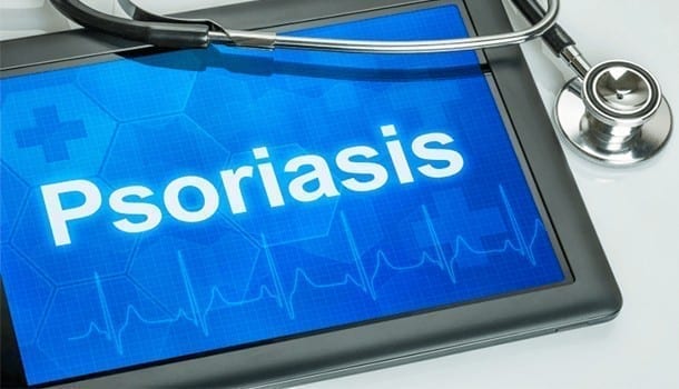 Treat Psoriasis at Home
