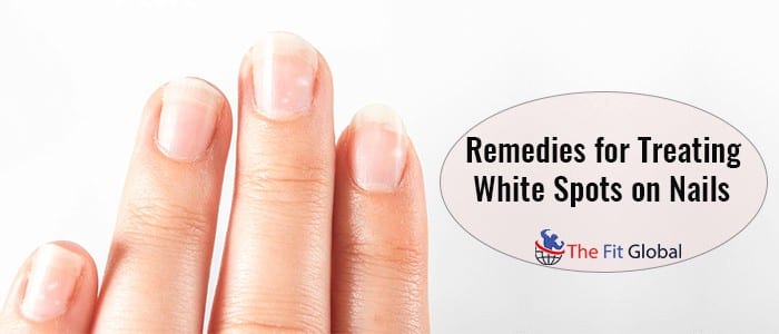 Remedies for Treating White Spots on Nails _Natural Remedies