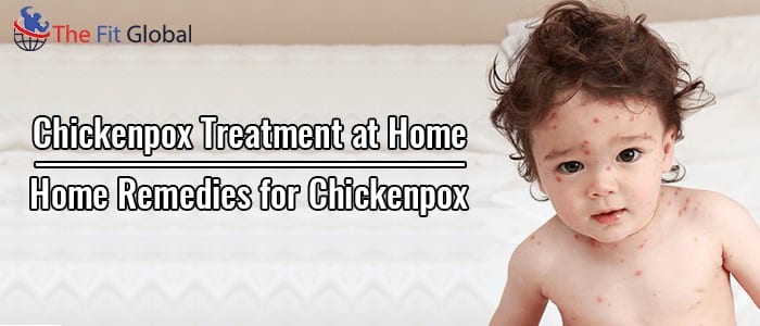 Chickenpox Treatment at Home Home Remedies for Chickenpox