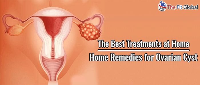 Home Remedies for Ovarian Cyst The Best Treatments at Home
