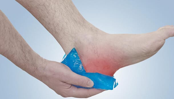 Press Some Ice Cold Packs Against Your Heels