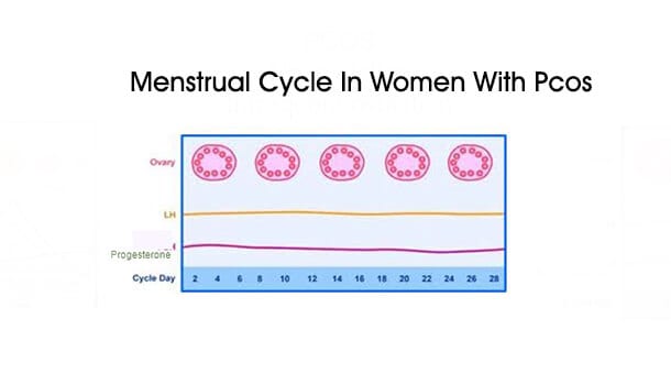 Menstrual Cycle In Women With Pcos