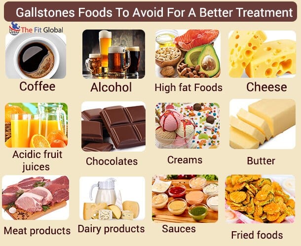 Gallstones Foods To Avoid For A Better Treatment