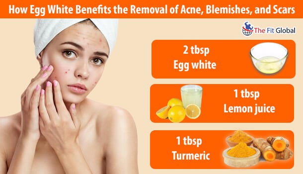 How Egg White Benefits the Removal of Acne, Blemishes, and Scars