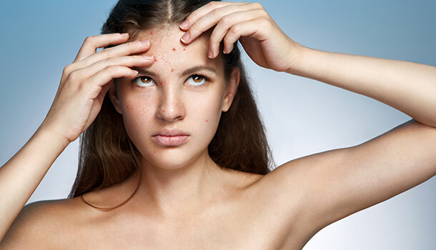 Impact on Your Skin Health (Acne Removal)