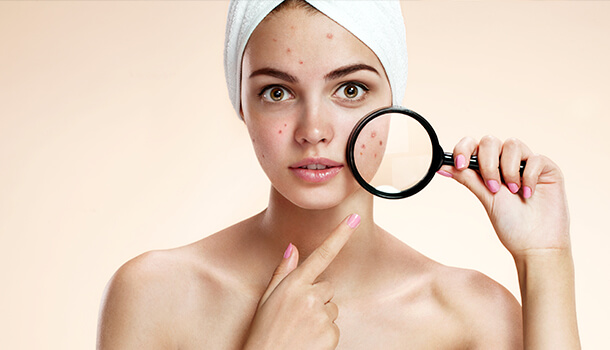 Vitamin E Oil Benefits For Skin – Treats Acne
